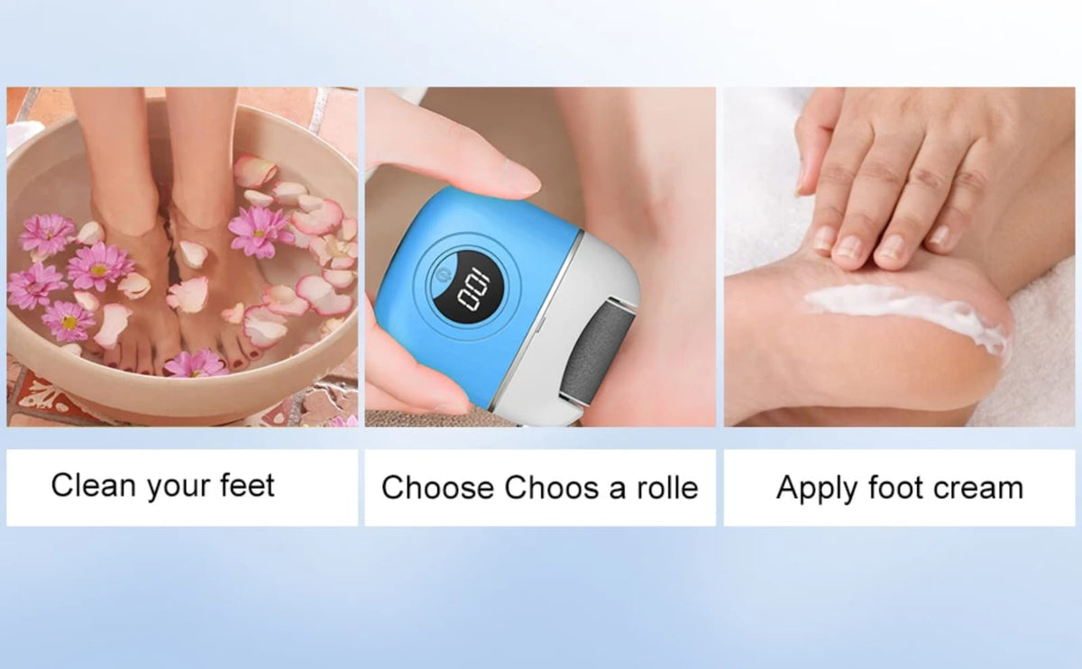 مكنة لازالة اللحم الميت من القدمين 3 رؤوس — Rechargeable Electric Foot Callus Remover with 3 Heads