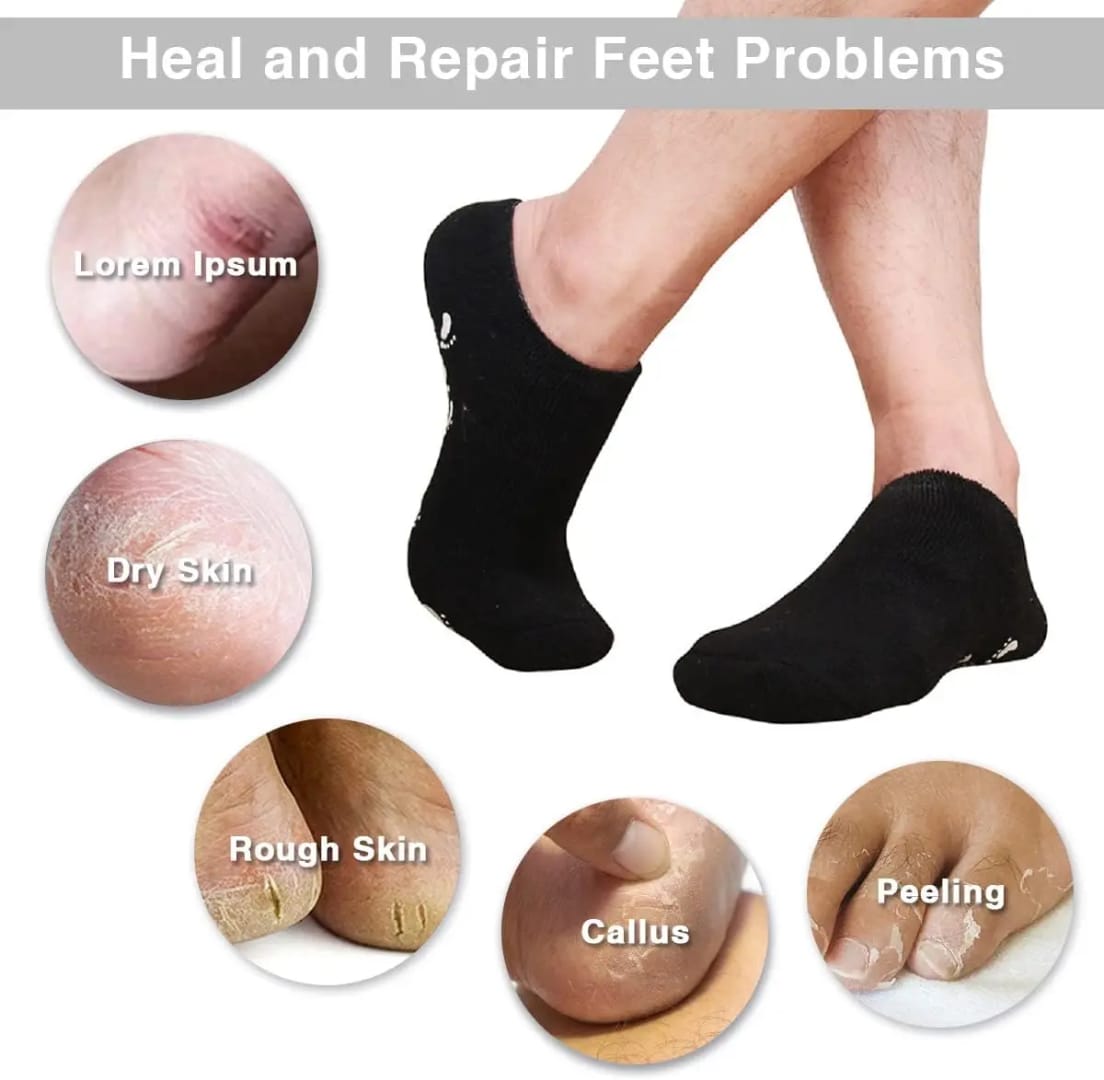 كلسات ترطيب القدمين بالجل والسيليكون مع قاعدة مانعة للانزلاق — Moisturizing Gel Socks with Non-Slip Sole