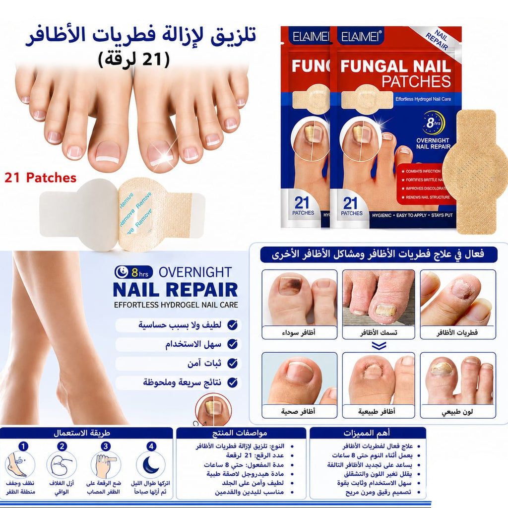 تلزيق لازالة فطريات الاظافر 21 لزقه — Antifungal Nail Treatment Patches – 21 Pieces